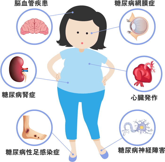 脳血管疾患 糖尿病網膜症 糖尿病腎症 心臓発作 糖尿病性足感染症 糖尿病神経障害