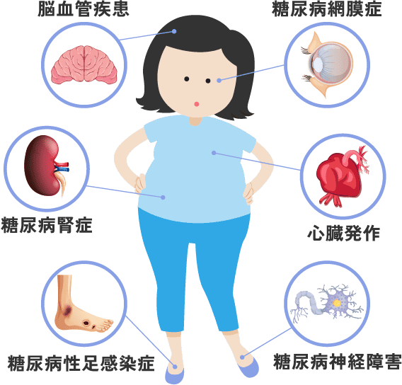 脳血管疾患 糖尿病網膜症 糖尿病腎症 心臓発作 糖尿病性足感染症 糖尿病神経障害
